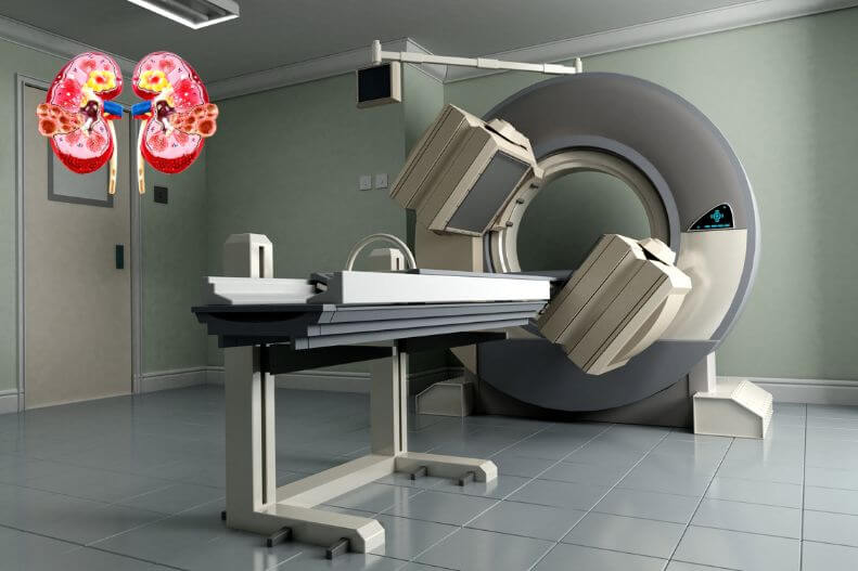 Best Ec Renal In Mohali