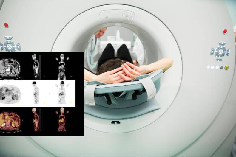 Best Pet CT Scan Centre In Mohali