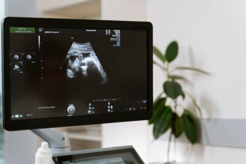 Ultrasound Sonography scan In Mohali